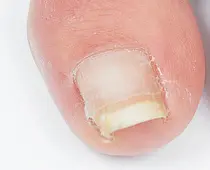 御茶ノ水 飯田橋 四ツ谷 東京 安い ネイルサロン お得に予約するなら ミニモ