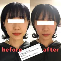 埼玉 小顔矯正 エステ リラクサロン お得に予約するなら ミニモ