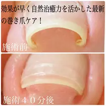 加古川市 ネイルサロン お得に予約するなら ミニモ 加古川市 ネイルサロン お得に予約するなら ミニモ