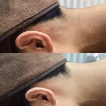 効果抜群脱毛✨ レイビスひかる🧸のプロフィール画像