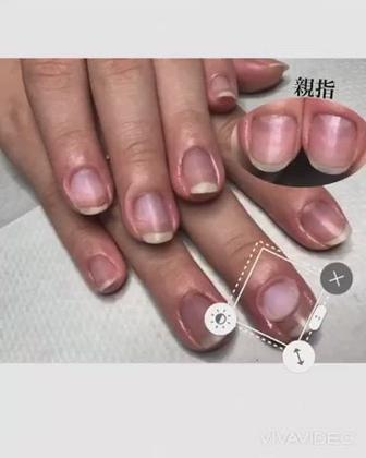 7ヶ月の深爪育成施術を続けた結果を動画にしました I様の場合は特に親指 人差し指 中指に劇的変化がみ ネイルサロンハピーナ自宅サロン所属 金沢 未緒のネイルデザイン ミニモ