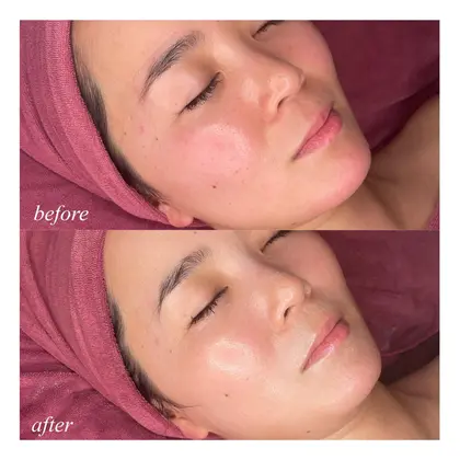 Ideare Ebisu所属 恵比寿インディバ 代表栁澤杏奈のエステ リラクカタログ ミニモ