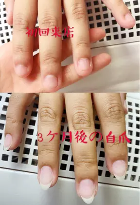 Q Free Nail Salon所属 Q Free Nailsのメニュー ミニモ