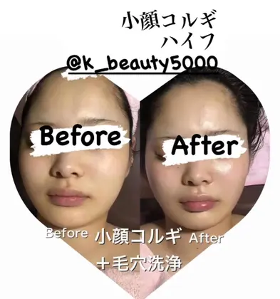 蓄熱式ハイ○の代わりエステ小顔