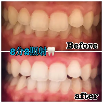 ポーラザビューティー池袋西口店のエステ リラクサロン スタッフ情報 前川 陽菜 Minimo ミニモ