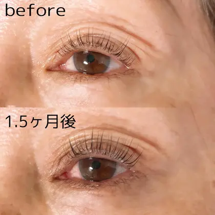 まつ毛育毛剤使用効果 Lash Room 101所属 林田 絵美子のマツエクデザイン ミニモ