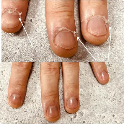 メンズ爪ケア爪の矯正 Salon De Ruby所属 レディース Wax メンズ眉毛脱毛のエステ リラクカタログ ミニモ