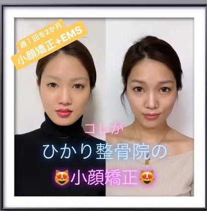 Emsとドイツ美容プラン ひかり整骨院所属 小顔矯正 全身整体 よもぎ蒸しひかり整骨のエステ リラクカタログ ミニモ