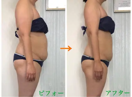 背中のラインづくり Ideal S アイディール エス所属 山本 ちえみのエステ リラクカタログ ミニモ