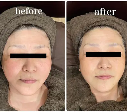 Piel Clara ピエルクララ 所属 金谷 美保のメニュー ミニモ Piel Clara ピエルクララ 所属 金谷 美保のメニュー ミニモ