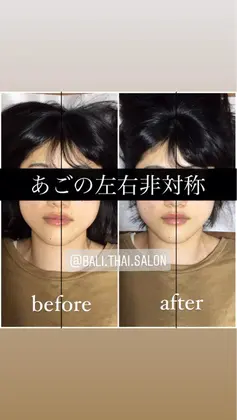 口角の高さが違う 口の歪み バリンタイ 心斎橋店 小顔矯正 骨盤矯正 姿勢矯正 歪み専門 筋膜整体サロン所属 歪み改善 バリンタイ すぎうらのエステ リラクカタログ ミニモ