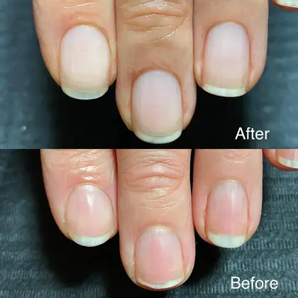 Hachi8 ハチハチ 所属 Hachi8 Nailのメニュー ミニモ