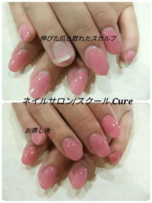 深爪のお客様 前回スカルプで長さを出してジェルを塗り塗り 今回は取れたスカルプと伸びた爪のお直し ネイルサロン スクール ボディジュエル ハンドメイド Cure所属 ネイリスト 友香のネイルデザイン ミニモ