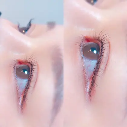 メトロポリタン 変わる 取り囲む マツエク 絡まる Bloma Jp