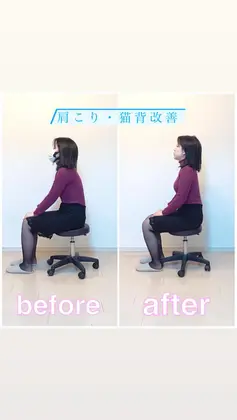 猫背と頭を小さくしたいということでご来店していただきました コースは頭蓋骨小顔矯正に猫背矯正を追 Total Body Care Salon Sunny所属 整体 筋膜オイル 小顔矯正 心斎橋 のエステ リラクカタログ ミニモ