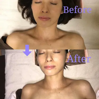 デコルテマッサージのビフォーアフター キュッと凝り固まった肩がほぐれ 肩の位置が下がりました 首 M S Labo所属 安江 麻衣のエステ リラクカタログ ミニモ