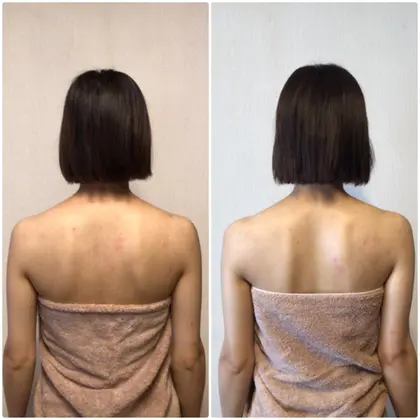 肩甲骨が中央に近づくと 肩幅が狭くなり 華奢な肩のラインになります 右側のアフター写真 背中の プライベートサロン Nico所属 Nico ビューティサロンのエステ リラクカタログ ミニモ
