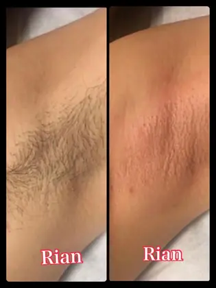 ブラジリアンワックス専門店rian リアンのエステ リラクサロン スタッフ情報 Rian Yumi ミニモ