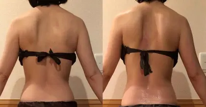 Shine所属 痩身専門 Shineのメニュー ミニモ