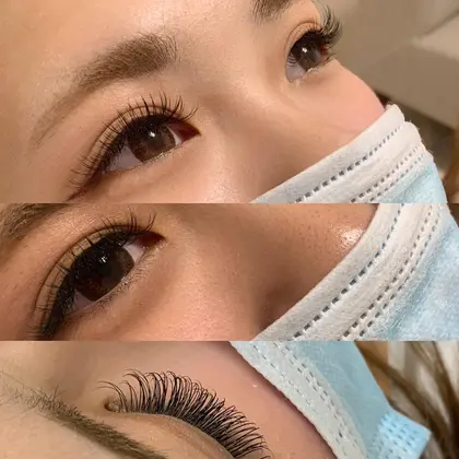 超えて 感嘆 ジョセフバンクス マツエク 古い Medical Village Jp