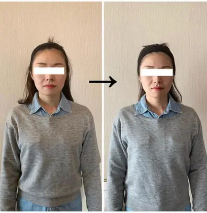 メイクしたまま施術ができるので 気軽に施術を受けて頂けます お顔のむくみが解消され 横幅がスッキリ Miri所属 小顔 ヘッドセラピー サロン北堀江店のエステ リラクカタログ ミニモ