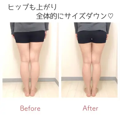 Radice所属 O脚 美脚矯正サロン Radiceのメニュー Minimo ミニモ