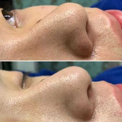 Repxia所属 増田 美希子のメニュー ミニモ