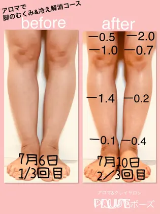 大人気の脚の冷え むくみ解消コース 夏になるとクーラーで脚の冷え だるさがひどくなる方が多くいら アロマ エステ Pause ポーズ 所属 浜野 恵美のエステ リラクカタログ ミニモ