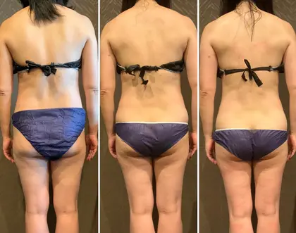 Charme所属 ハイパーナイフ 痩身 Charme面屋のメニュー ミニモ