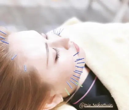 アイリー整骨院 普天間院のエステ リラクサロン スタッフ情報 アリメ 普天間 ミニモ