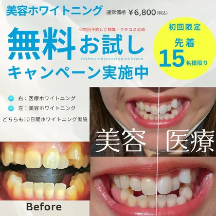 【医療提携】ホワイトニングメニュー導入　単品可 医療提携】ホワイトニングメニュー導入単品可