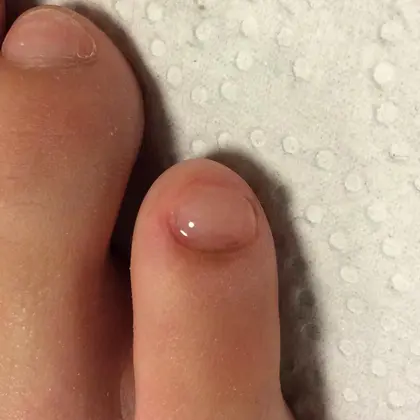 ママー また2枚にわれちゃって痛い いつも二枚にパクッと割れちゃう あし小指 爪を フットケアサロンrelaxing リラクシング 所属 しおばらのエステ リラクカタログ ミニモ ママー また2枚にわれちゃって痛い いつも二枚にパクッと割れちゃう あし小指 爪を フットケアサロンrelaxing リラクシング 所属 しおばらのエステ リラクカタログ ミニモ