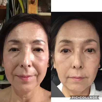 Emsとドイツ美容プラン ひかり整骨院所属 小顔矯正 全身整体 よもぎ蒸しひかり整骨のエステ リラクカタログ ミニモ