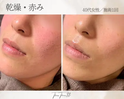 肌質改善×美肌サロンTHREE THREE(元町中華街駅)のエステ・リラクサロン