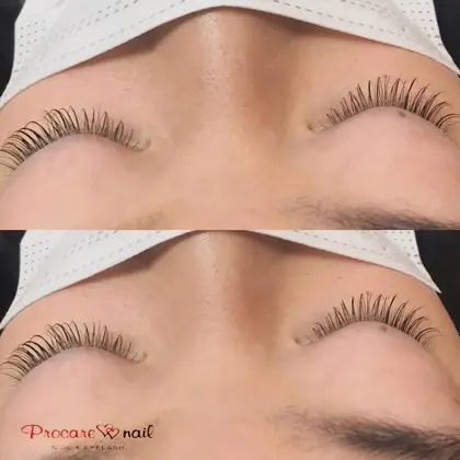 初まつ毛パーマ 緩めでナチュラルに プロケアネイル Nail Eyelash 吉祥寺店所属 さわの ゆかりのエステ リラクカタログ ミニモ