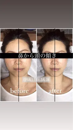 頭蓋骨の歪み 鼻の歪み 頭の歪み 目の高さ バリンタイ 心斎橋店 小顔矯正 骨盤矯正 姿勢矯正 歪み専門 筋膜整体サロン所属 歪み改善 バリンタイ すぎうらのエステ リラクカタログ ミニモ