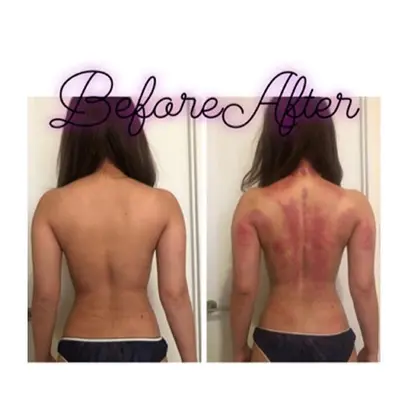 かっさ 黄土漢方蒸し バストアップ Belinda所属 かっさ 漢方蒸し バ スト Belindaのエステ リラクカタログ ミニモ