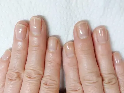 アトピーお持ちのお客様ですが 爪はもちろん指も手もつるんと綺麗になりました Nail Salon Rufu所属 Nail Salon Rufu ルフ の ネイルデザイン ミニモ アトピーお持ちのお客様ですが 爪はもちろん指も手もつるんと綺麗になりました Nail Salon Rufu所属 Nail Salon Rufu ルフ の ネイルデザイン ミニモ