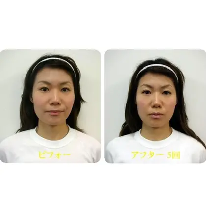 関西プロポーション小顔センター 大阪梅田院所属 吉信 のメニュー ミニモ