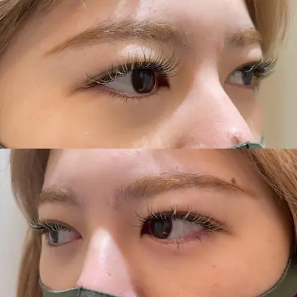 Forte Garden Hills Very所属 マツパイヤリング カラーゆらのメニュー ミニモ