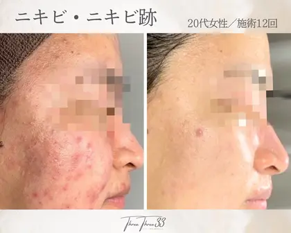 肌質改善×美肌サロンTHREE THREE(元町中華街駅)のエステ・リラクサロン