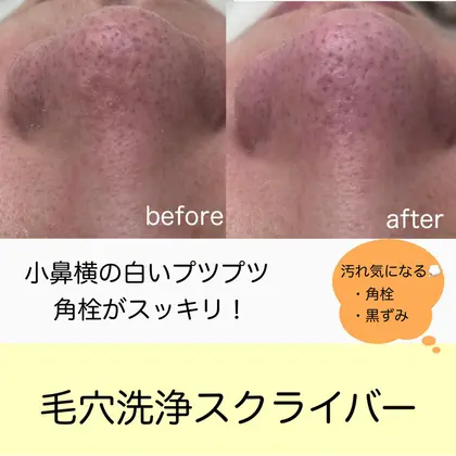 Clair静岡のエステ リラクサロン エステティシャン セラピスト情報 フェイシャルエステ Clair静岡 影山 ミニモ