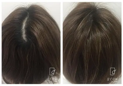 生え際がガタガタしてきていませんか 小顔効果にも重要な顔周りの毛 産毛だらけになっていると やがて Grow By K Two所属 高橋 ゆかのヘアカタログ ミニモ