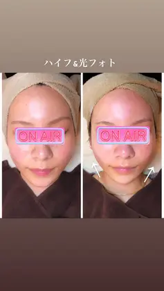 美顔秘密基地okinawaのエステ リラクサロン スタッフ情報 美顔秘密基地 沖縄 ミニモ