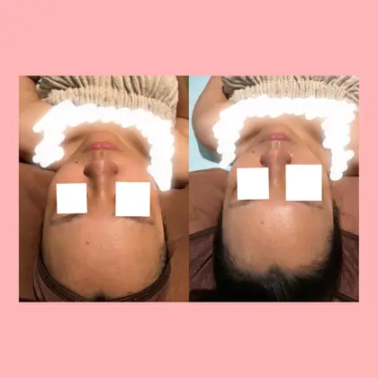 Lumia Beauty所属 Lumia Beauty横浜のメニュー ミニモ