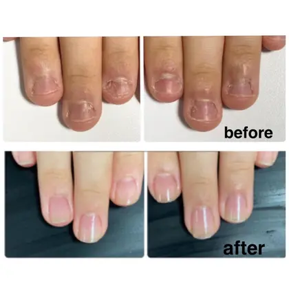 Eclatのネイルサロン ネイリスト情報 センター南 Nail Eclat ミニモ