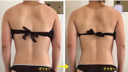 背中のラインづくり Ideal S アイディール エス所属 山本 ちえみのエステ リラクカタログ ミニモ