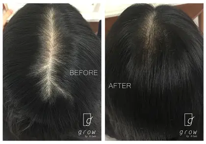 生まれつきの細毛だから と諦めていませんか 髪の毛の質は 頭皮で決まります 生まれながらでは Grow By K Two所属 高橋 ゆかのヘアカタログ ミニモ