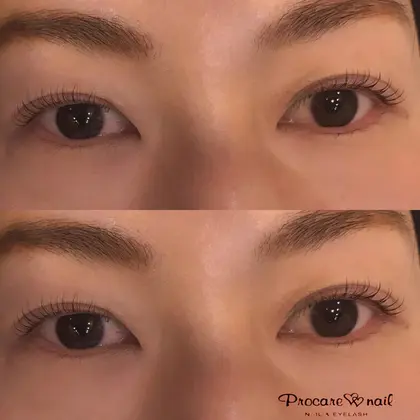 初まつ毛パーマ 緩めでナチュラルに プロケアネイル Nail Eyelash 吉祥寺店所属 さわの ゆかりのエステ リラクカタログ ミニモ