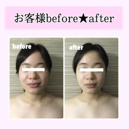 小顔4000ショットアロマリンパマッサージ Rise Salon所属 光脱毛小顔 エステriseのエステ リラクカタログ ミニモ